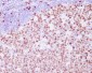 Anti-Ki67 MKI67 Rabbit Monoclonal Antibody